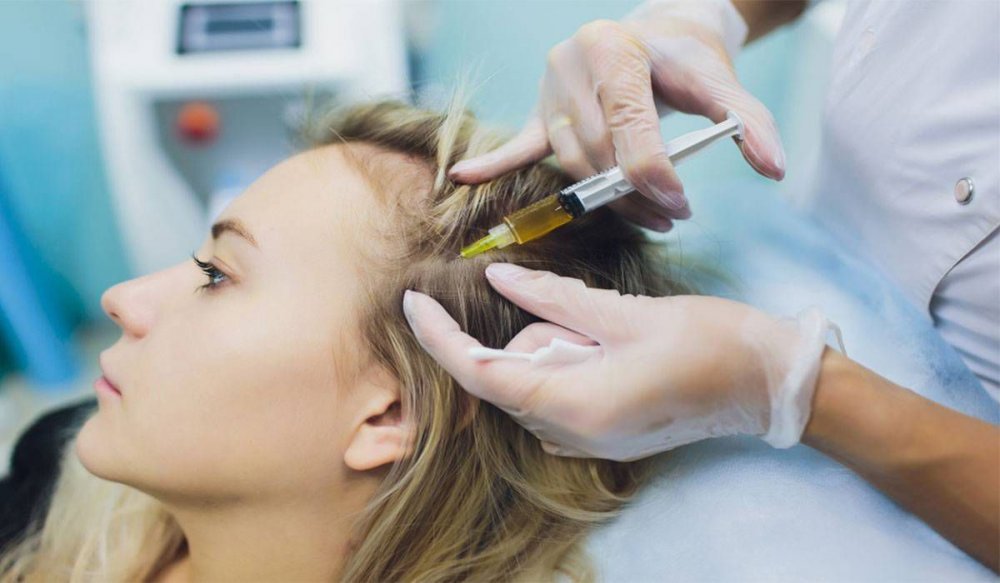 فوائد حقن البلازما لعلاج مشاكل الشعر 